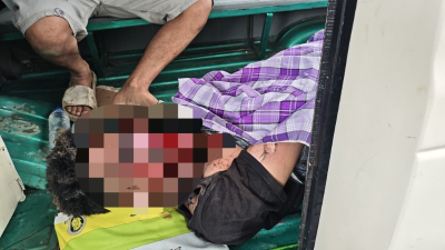 Ledakan Petasan di Mangunjaya Pangandaran, Dua Pemuda Luka Parah